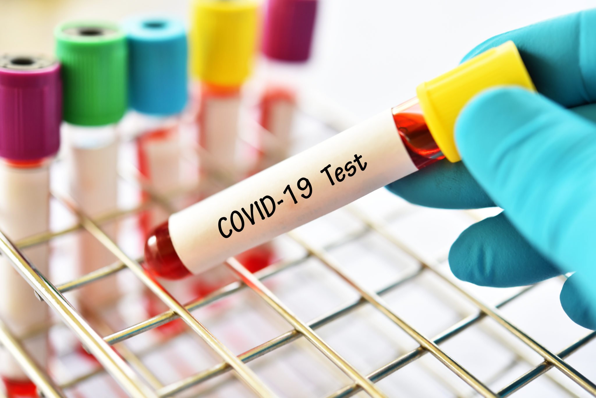 TEST COVID